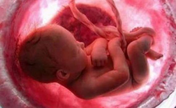 Una dieta a basso contenuto di carboidrati in gravidanza aumenta il rischio di malformazioni del tubo neurale.