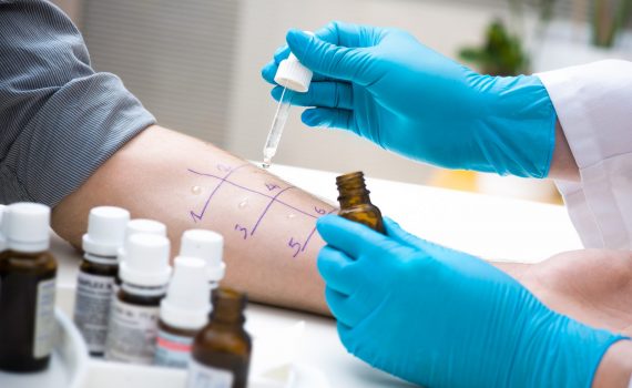 Allergie alimentari e sicurezza del consumatore: documento di indirizzo e stato dell’arte – Italia 2018, Ministero della Salute