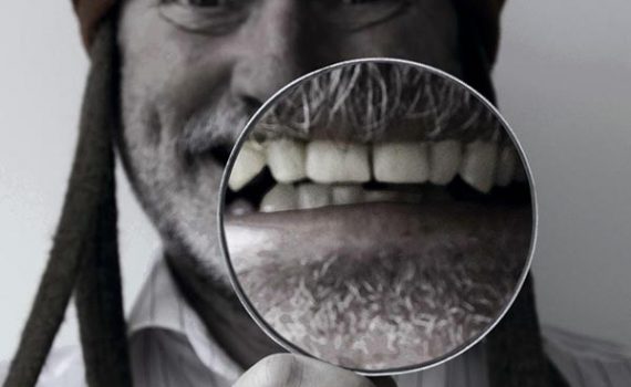 Importância da saúde bucal na terceira idade