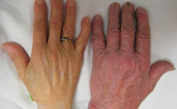 Prevalência de anemia entre pacientes idosos em salas de emergências