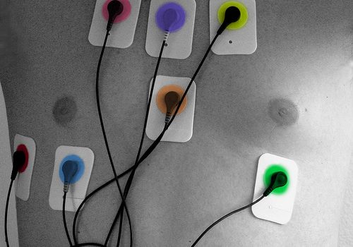 Hipertensão lentamente se transforma em uma pandemia