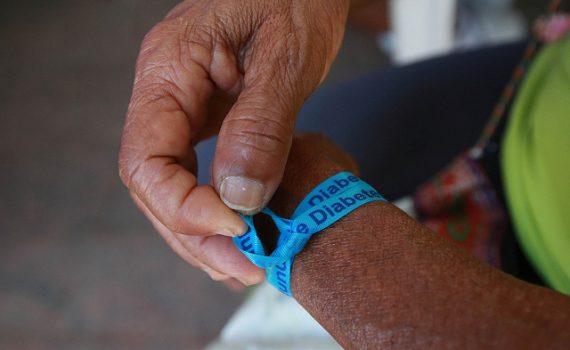 Estudo prova treinamento vibratório para pacientes com diabetes mellitus tipo 2