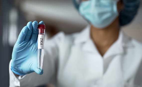 Efeitos do Zika podem ser maiores em casos de desnutrição