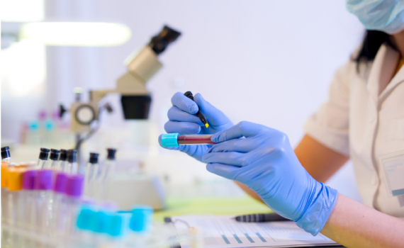 Perfusão de sangue pode melhorar problemas de memória