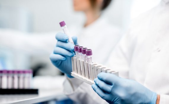 Novo método para detectar Alzheimer