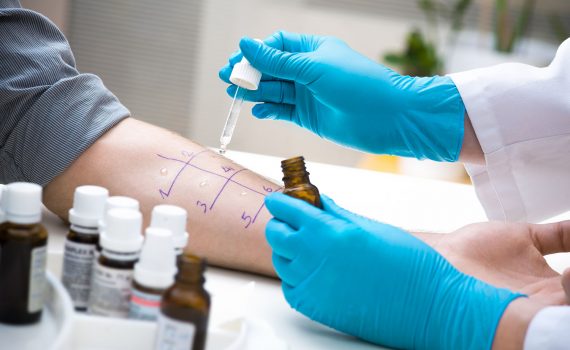 Evitar reações anafiláticas com uma pílula