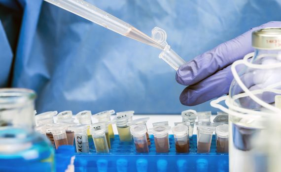 Microbioma poderia estar vinculado ao risco de desenvolver leucemia