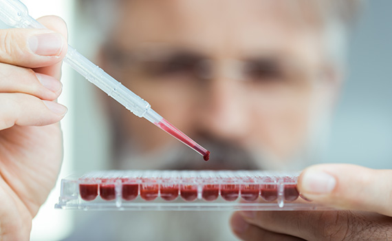 Um médico a analisar biomarcadores plasmáticos num laboratório. Um médico a analisar biomarcadores plasmáticos num laboratório.