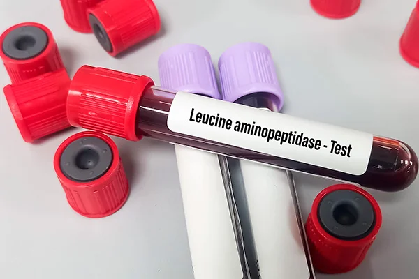 Amostras de sangue em tubos de ensaio sobre uma mesa.