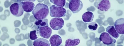 cancercells-seiscien-x-cuatrocien