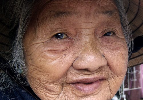 Recomendaciones para cuidar la piel de los ancianos