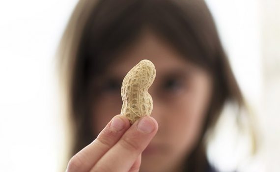 Estudio encuentra alérgenos alimentarios en el líquido amniótico