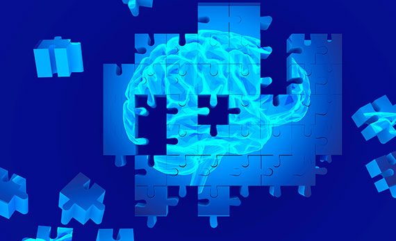 Alzheimer destrona al VIH en “top ten” de enfermedades mortales