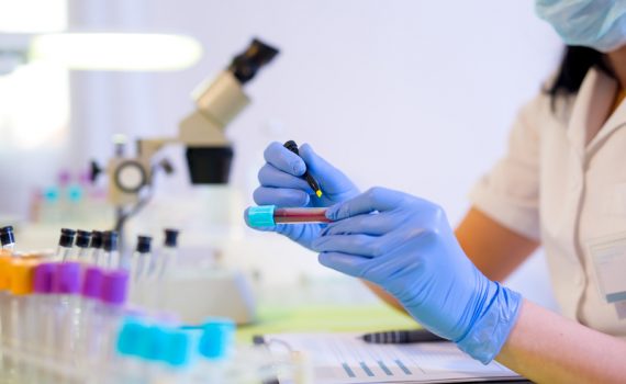 La perfusión sanguínea podría mejorar los problemas de memoria