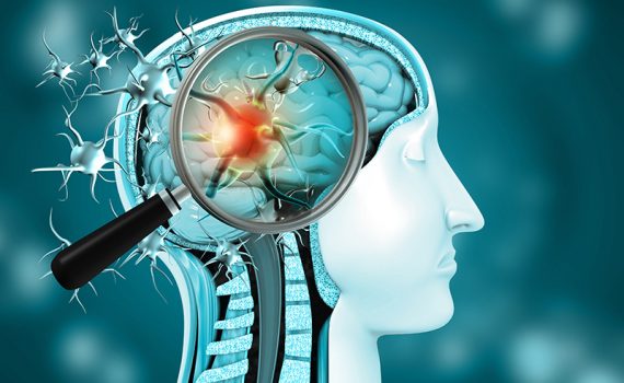 Cómo cambia el cerebro tras una infección de covid-19, incluso leve