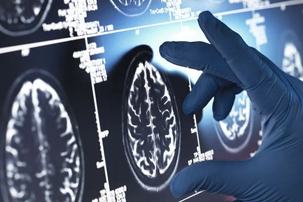 Estudio piloto sobre la bioenergética cerebral y el desempeño cognitivo